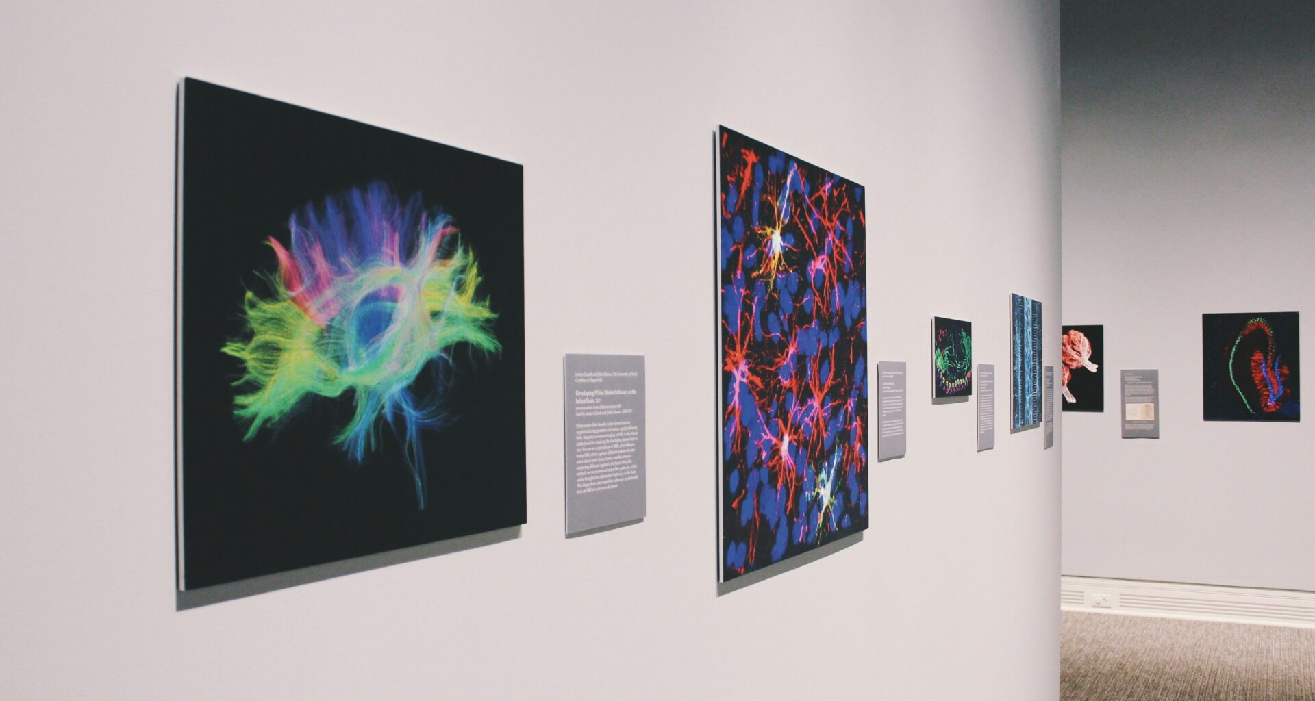 art gallery with images of the brain
