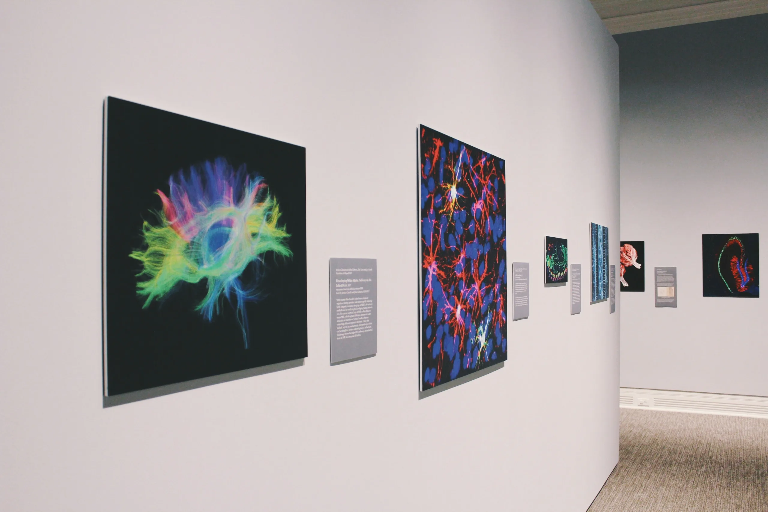 art gallery with images of the brain